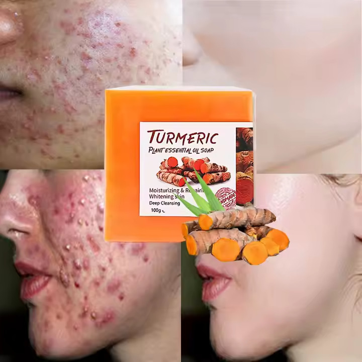 2PCS handmade tumeric bar soap bath anti acne dark spots removal and whitening.