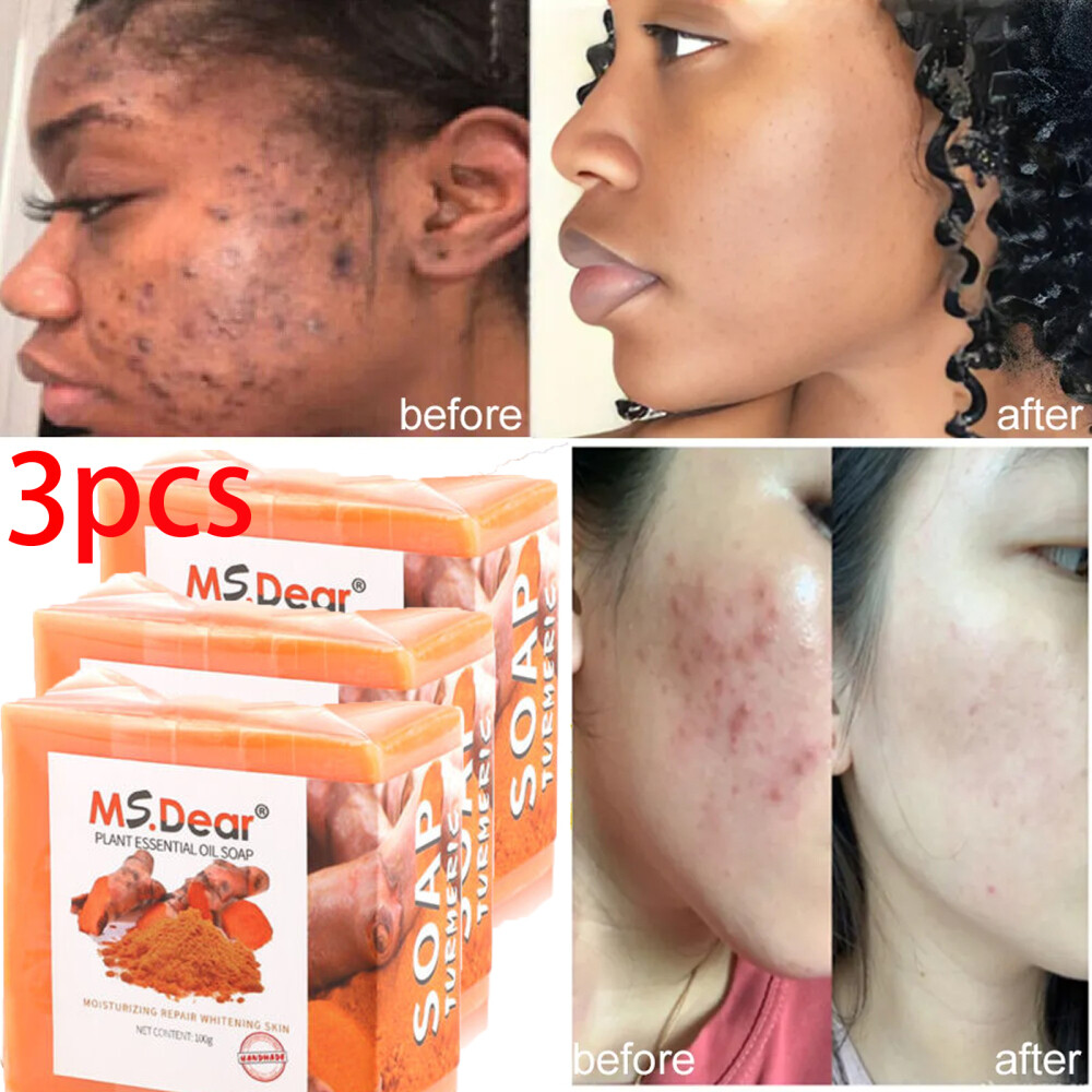 3Pcs Ms.Dear Tumeric Soap Skin Whitening Dark Spots lightening Acne Brightening