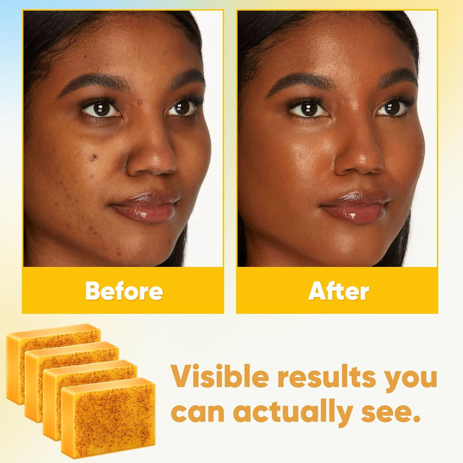 4 Pack Turmeric Soap, 100G Kojic Acid and Turmeric Soap Bar, Gently Clean the Fa