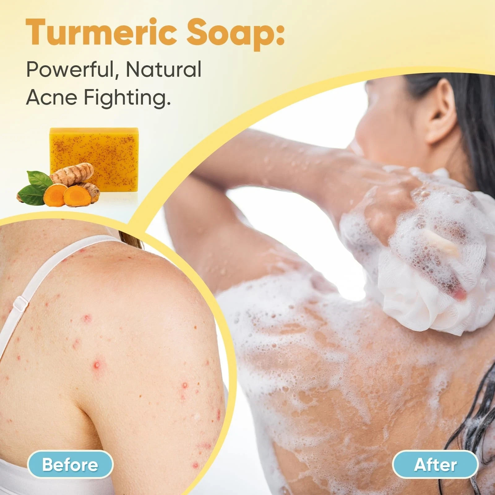5 Pack Turmeric Soap, 80g Kojic Acid and Turmeric Soap Bar, Gently Clean the..