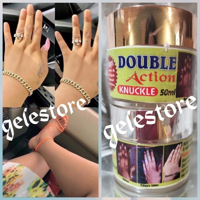 Double Action Knuckle, Cream With Kenacol Oil . 50mlx 1 👌
