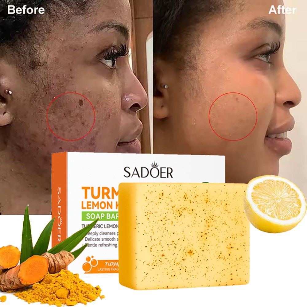 Lemon Turmeric Kojic Acid Soap Bar, Turmeric Face and Body Soap, Deep Clean 100g