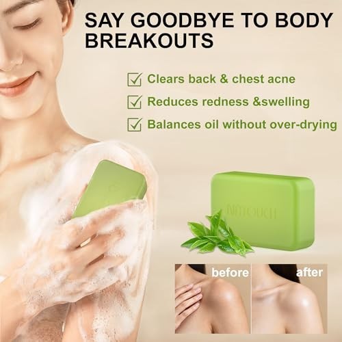 Antifungal Medicated Soap Bar, Athletes Foot Jock Itch Ringworm Yeast Infection