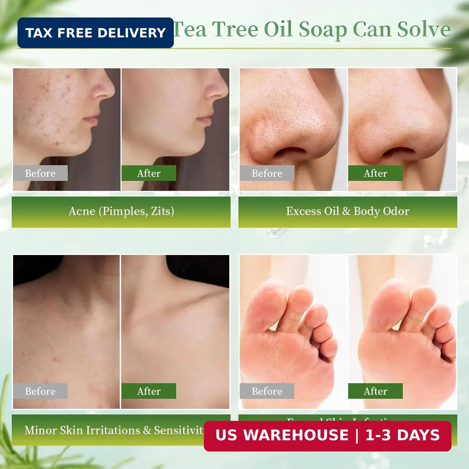 Antifungal Relief Soap Bar, Tea Tree Oil Soap, Natural Foot & Body Soaps for Hea
