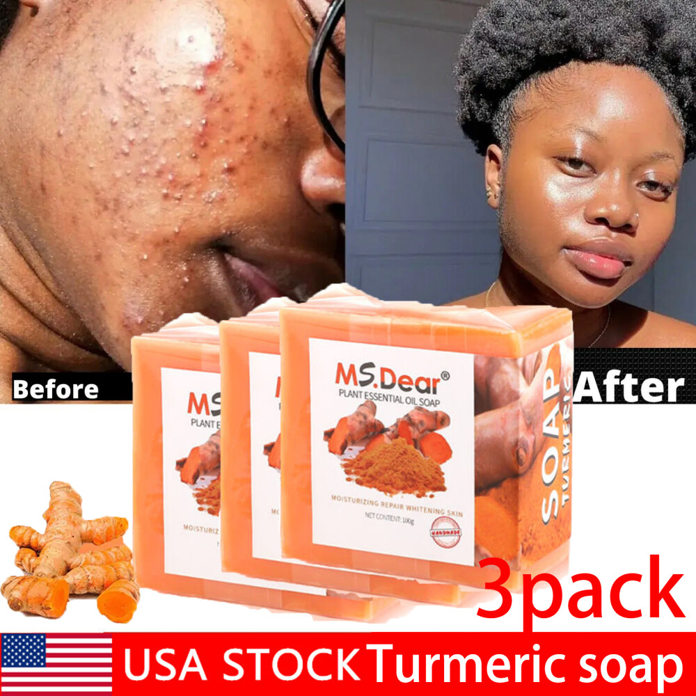 Tumeric Soap For Dark Spots, Skin Lightening, Anti Acne Skin Cleansing Soap Bar