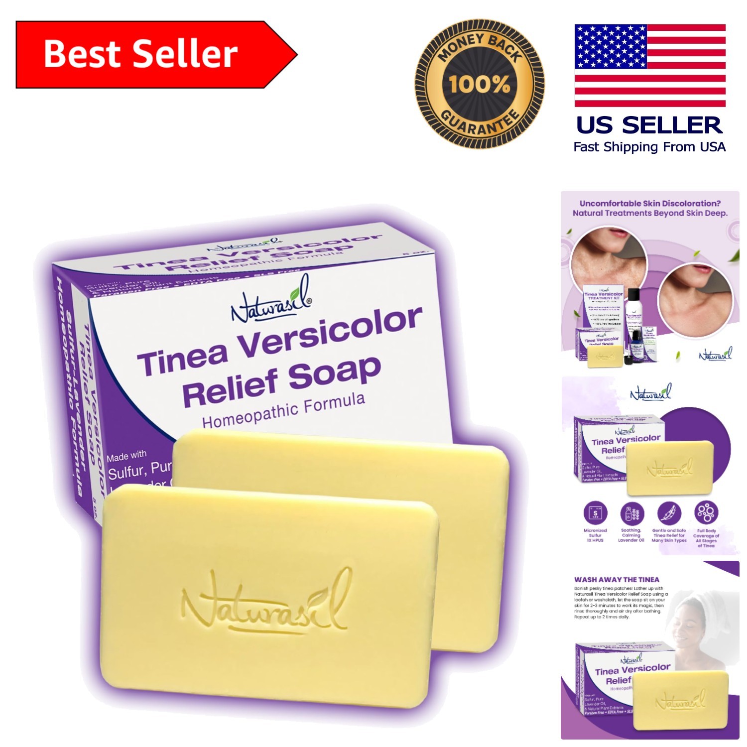 Soothing Sulfur Soap for Tinea Versicolor – Child & Adult Safe, Lavender Scented