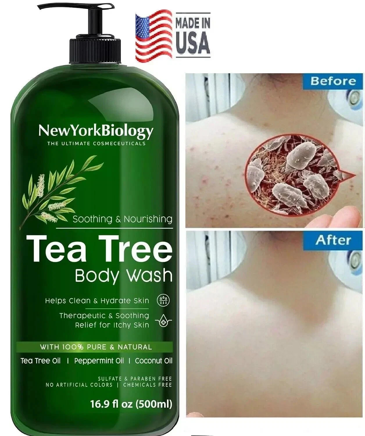 Therapeutic Soap Antifungal and Antibacterial Body Eliminate Fungus Ringworm Acn