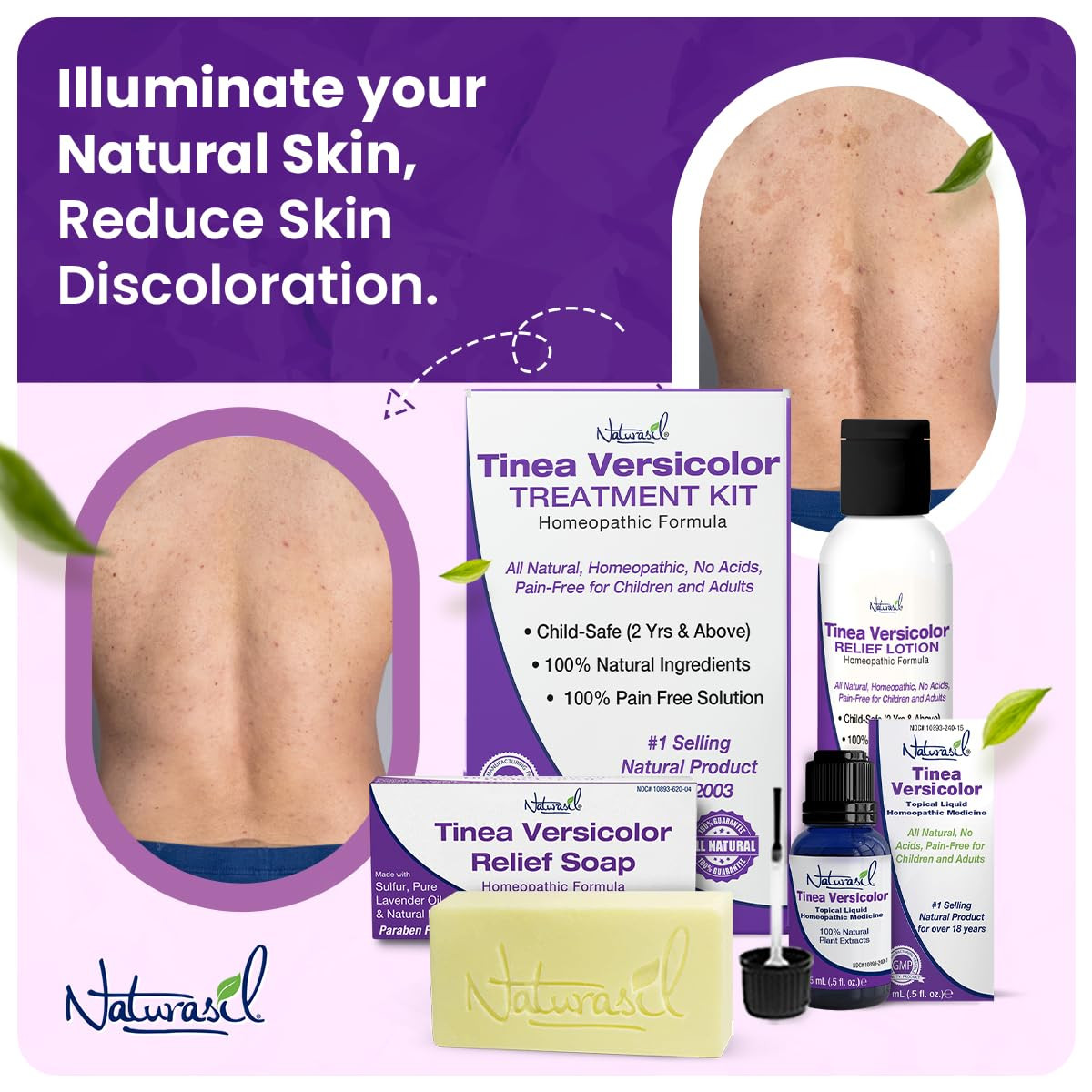 Tinea Versicolor Treatment +2 Bars | Max-Strength 10X Soap | Antifungal Microniz