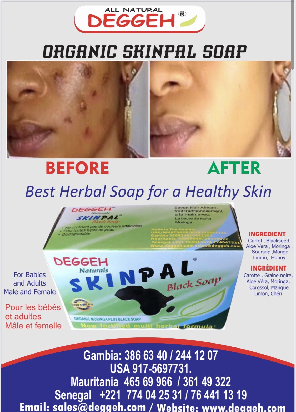 MORINGA Organic Herbal African Black Soap- 12