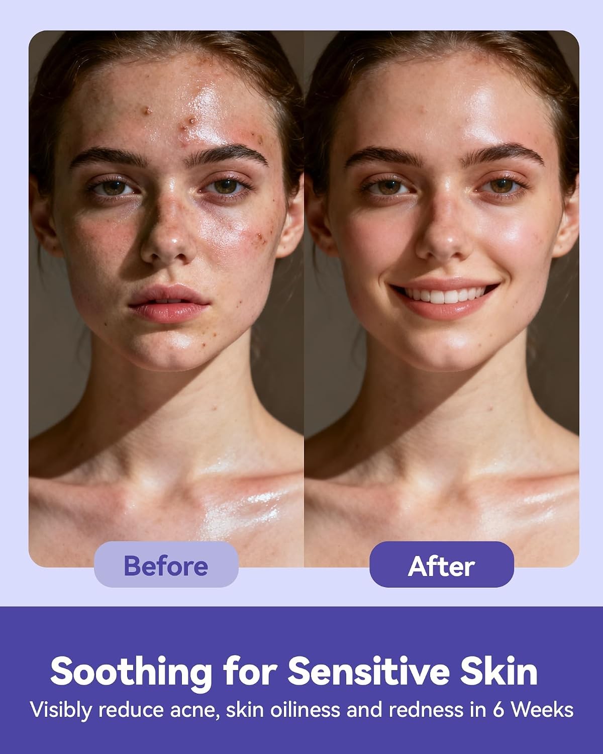 Disposable Face Towels, 10″×12″ XL Face Towelette Disposable, Soft Makeup
