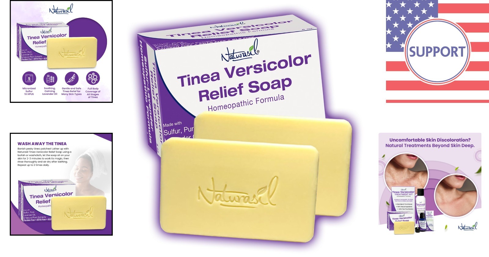 Soothing Sulfur Soap for Tinea Versicolor – Child & Adult Safe, Lavender Scented