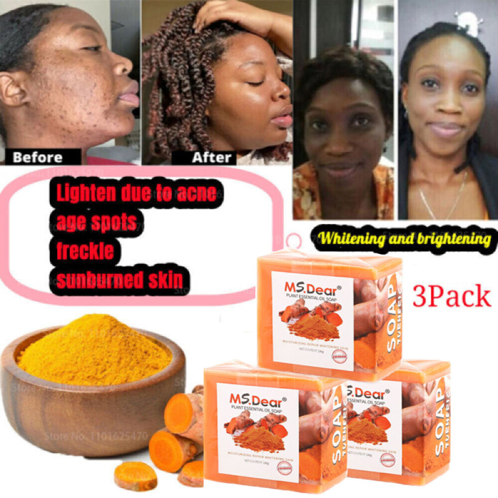 3PCS Turmeric Soap Skin Whitening Dark Spots Lightening Acne Brightening Tumeric