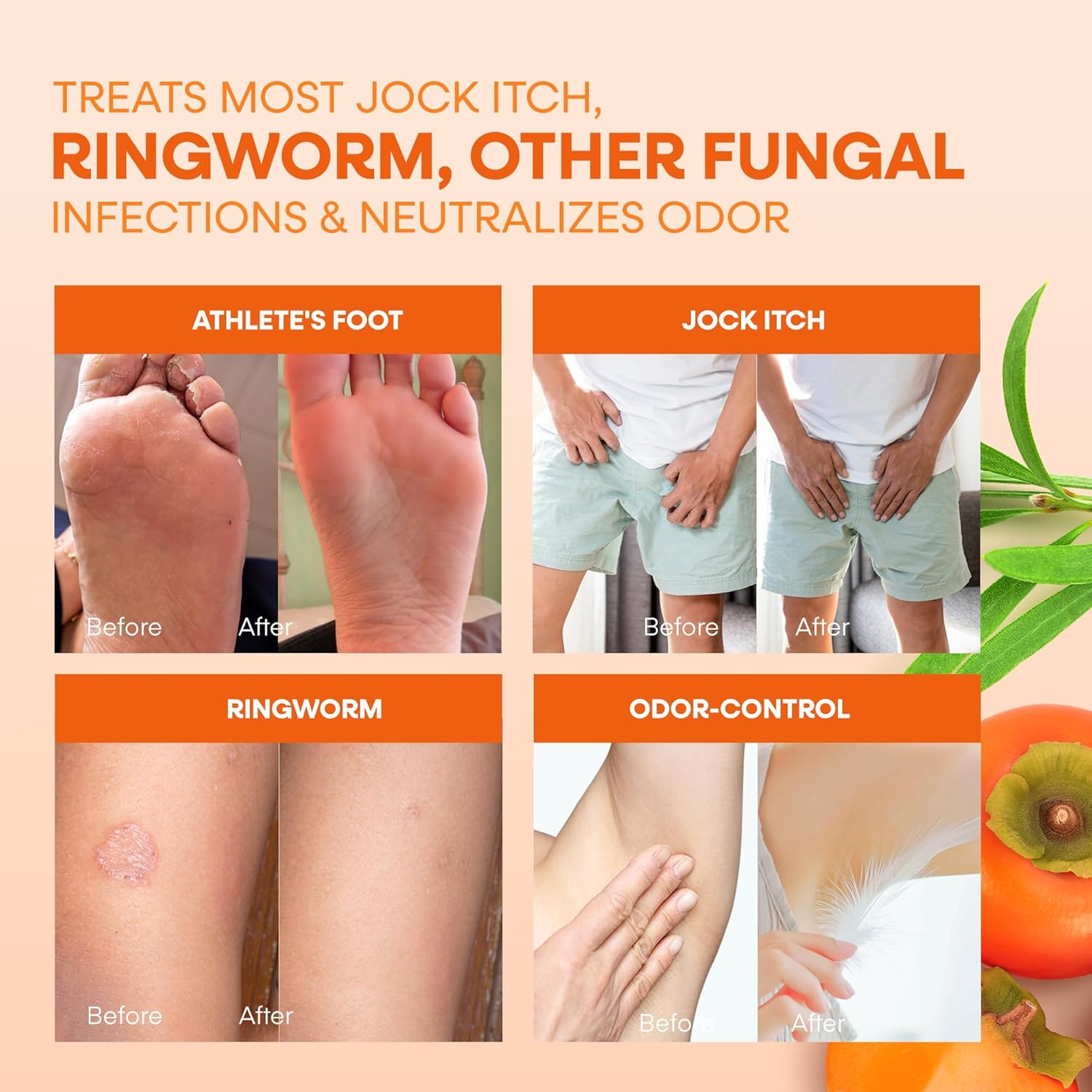 Antifungal Soap Bar: Antifungal Soap Treatment for Ringworm, Jock Itch & Athlete