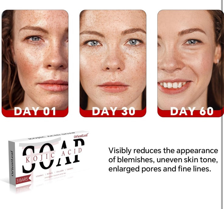 3PCS Tumeric Soap Skin Whitening Dark Spots lightening Acne Brightening Turmeric