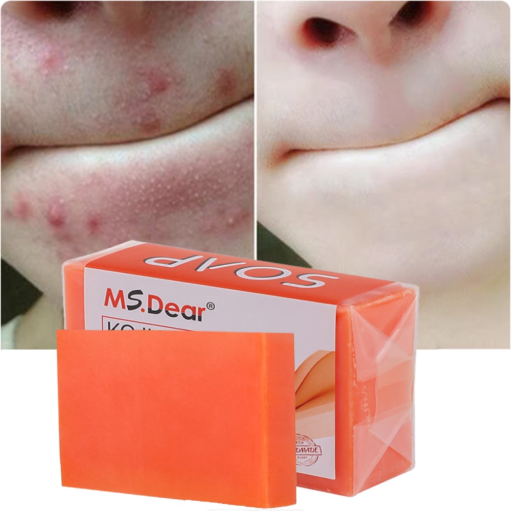 1Pcs Kojic Acid Soap Dark Spot Whitening Turmeric Skin Bleaching Lightening 100g