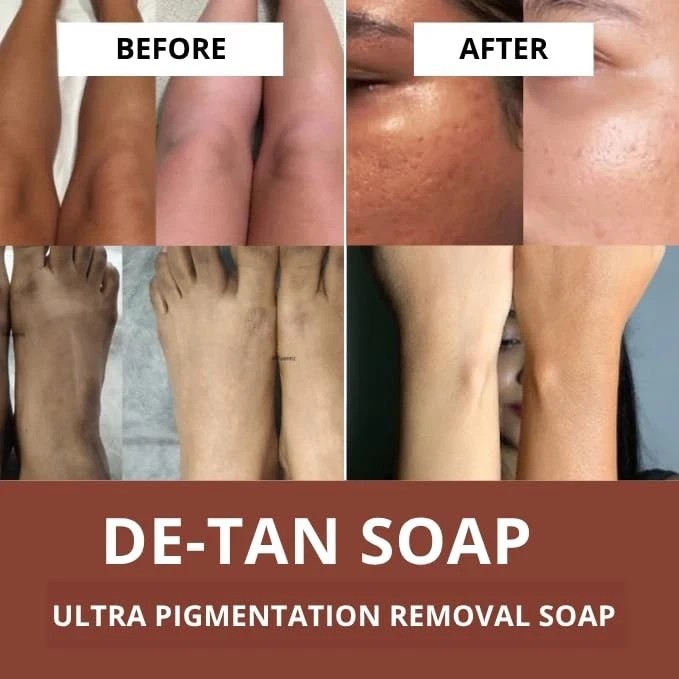BAKE De-Tan Coffee Soap – 2 x 100g Bars | Anti-Tan, Pigmentation & Dark Spot