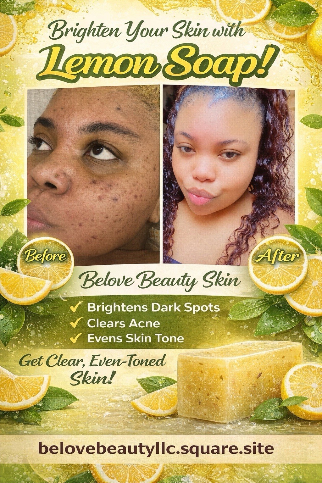 Tumeric Soap For Dark Spots, Skin Lightening, Anti Acne Skin Cleansing Soap Bar~