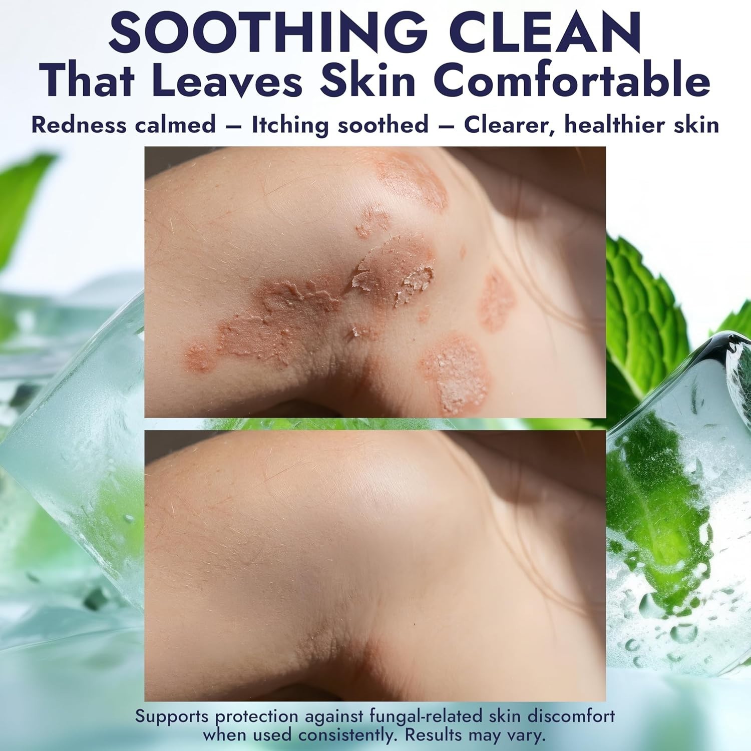 Antifungal Soap Infused with Peppermint Essential Oil | Medicated Tolnaftate 1%