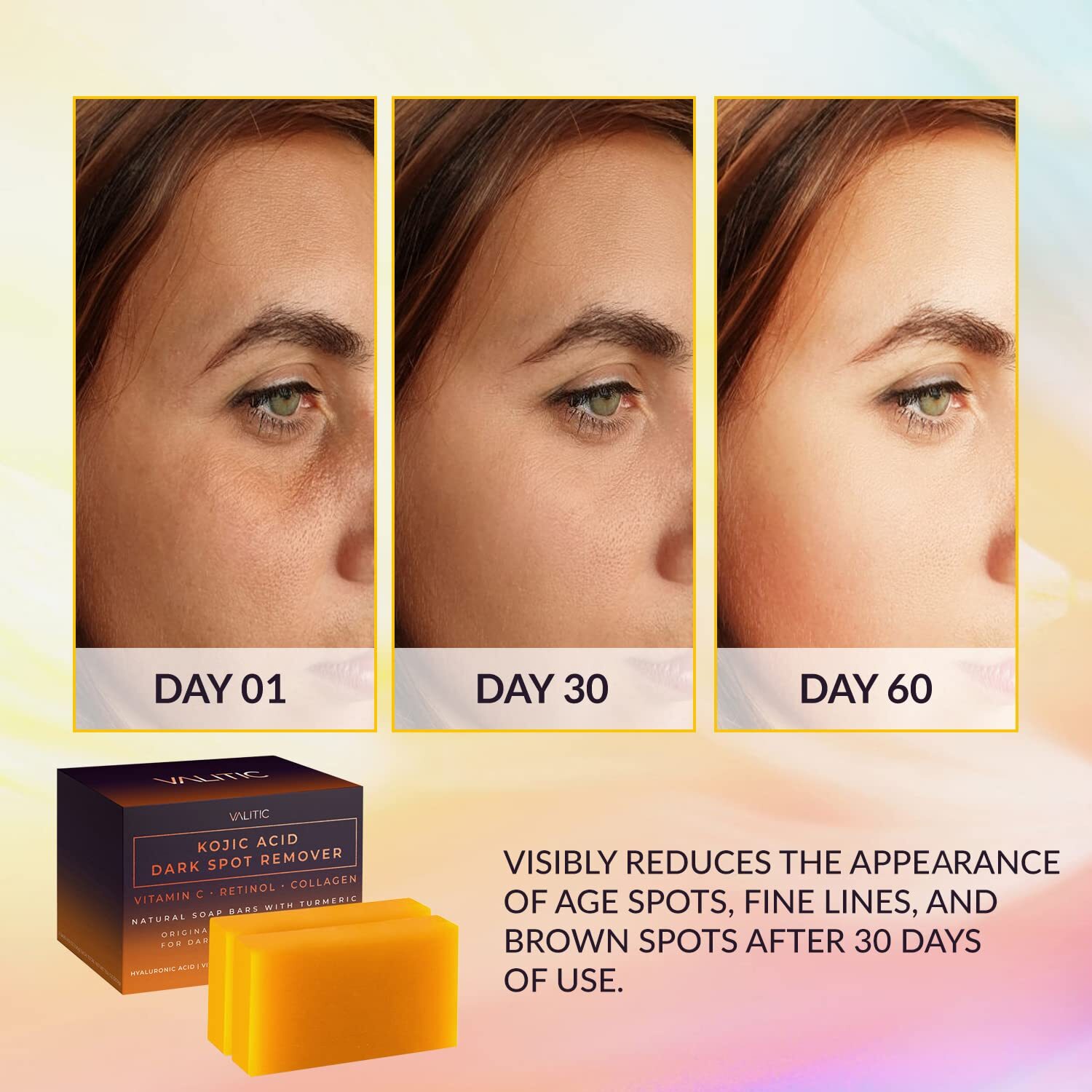 Kojic Acid Dark Spot Remover Soap Bars w/ Vitamin C, Retinol, Collagen(2 Pack)