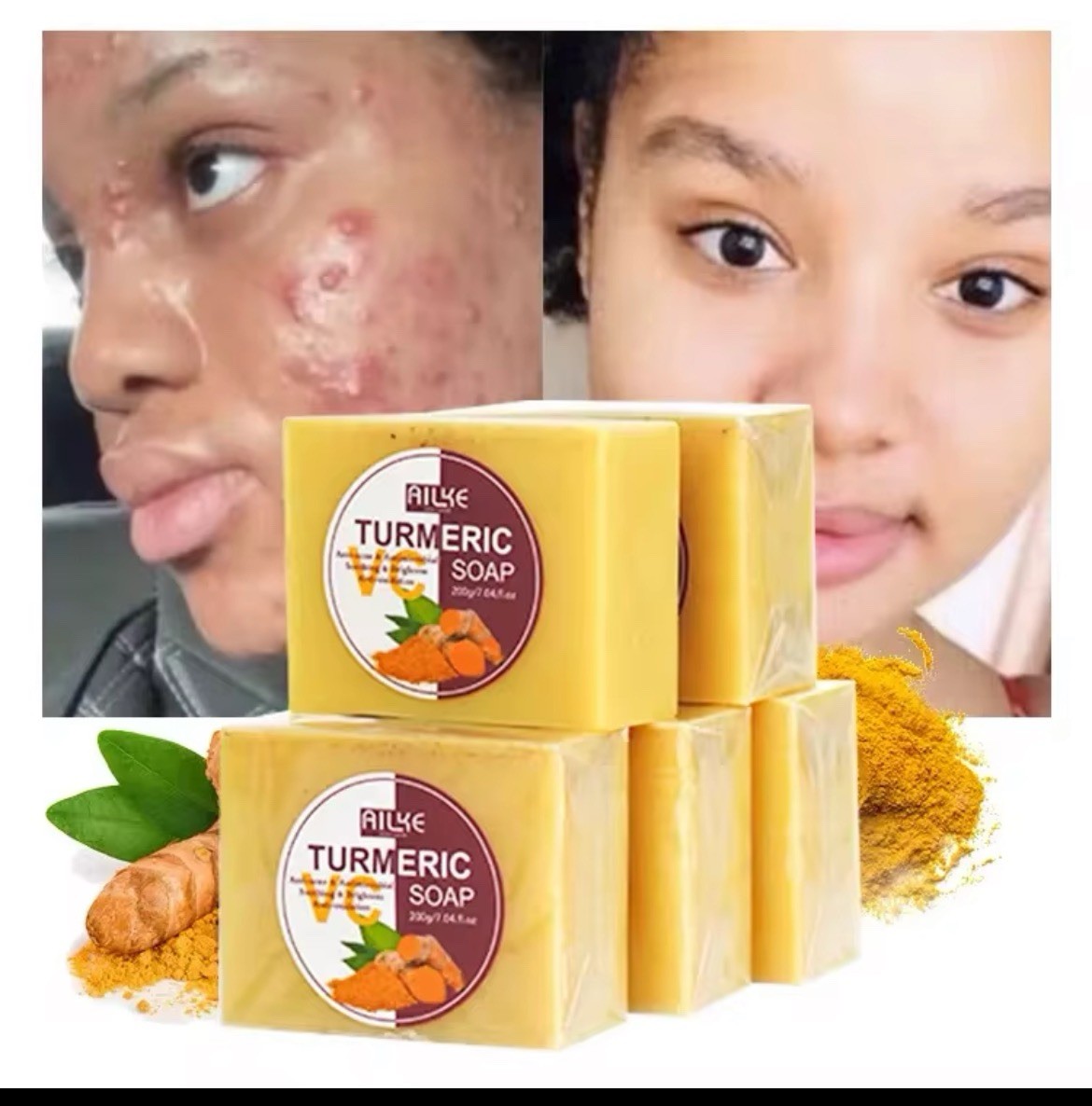 Tumeric Soap Skin Whitening Dark Spots lightening Acne Brightening Turmeric 100g