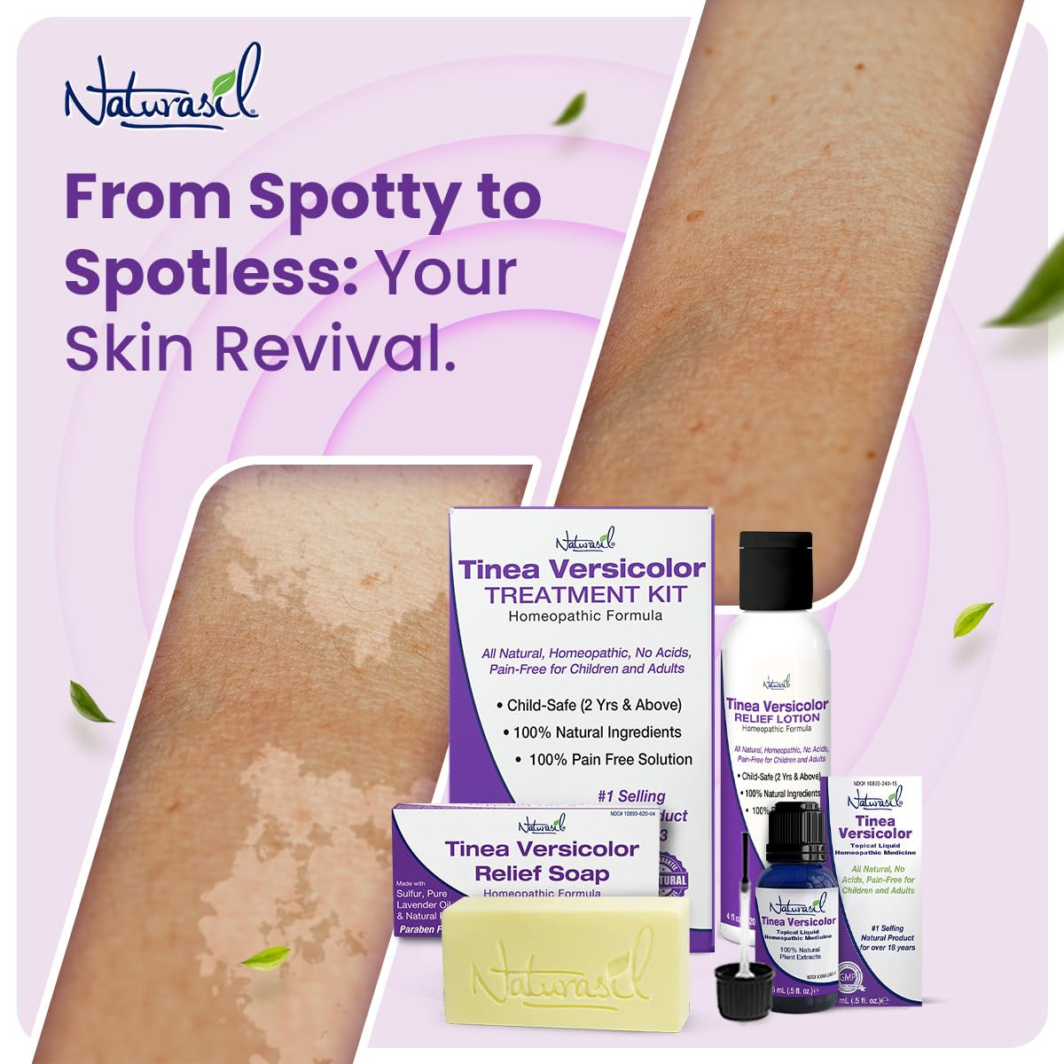 Tinea Versicolor Treatment +2 Bars | Max-Strength 10X Soap | Antifungal Microniz