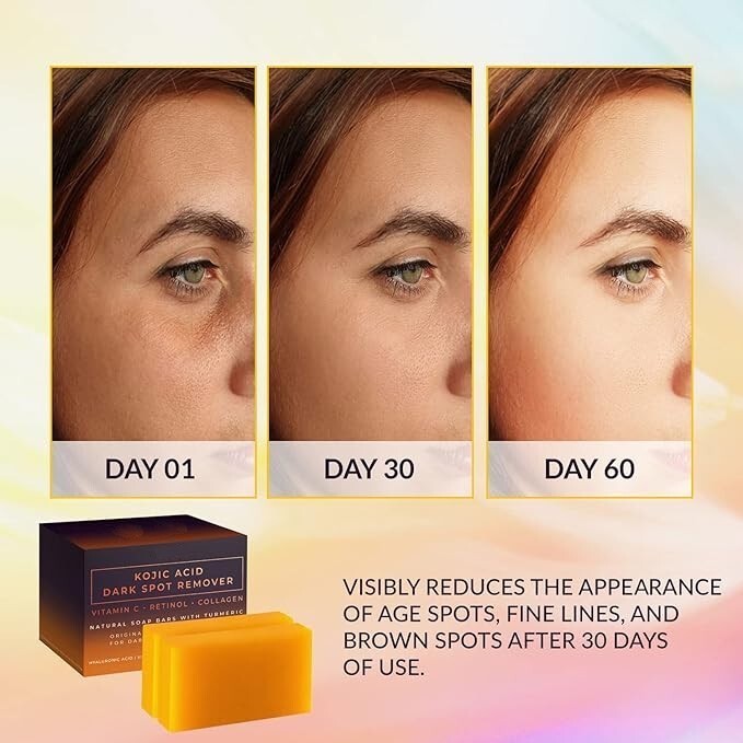 Pure Vital Kojic Acid Dark Spot Remover Soap Bars with Vitamin C, Retinol,2 Pack