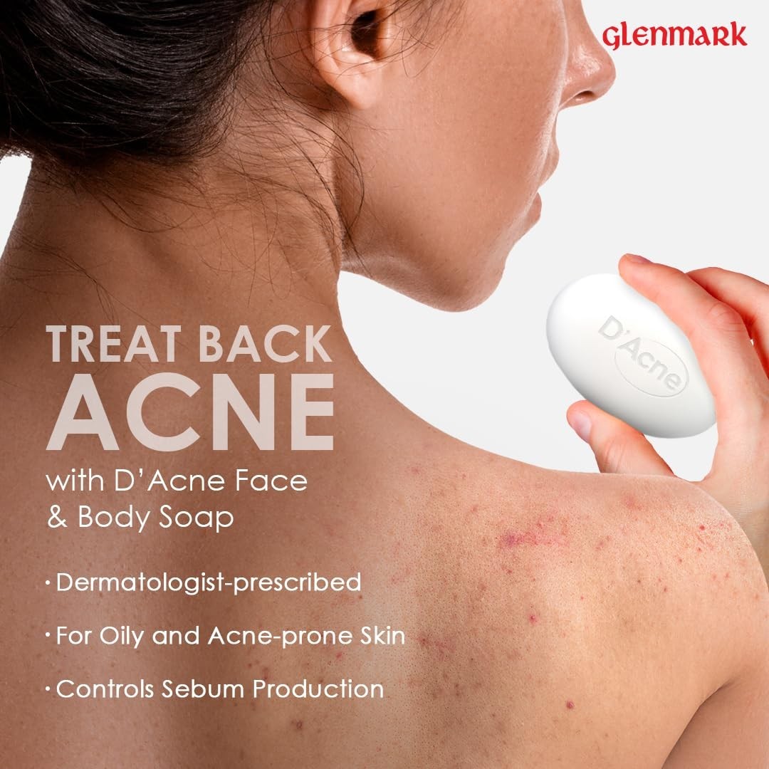 D’Acne Soap 75g Acne Face & Body Soap Controls Oily Skin Reduces Sebum Pack of 2
