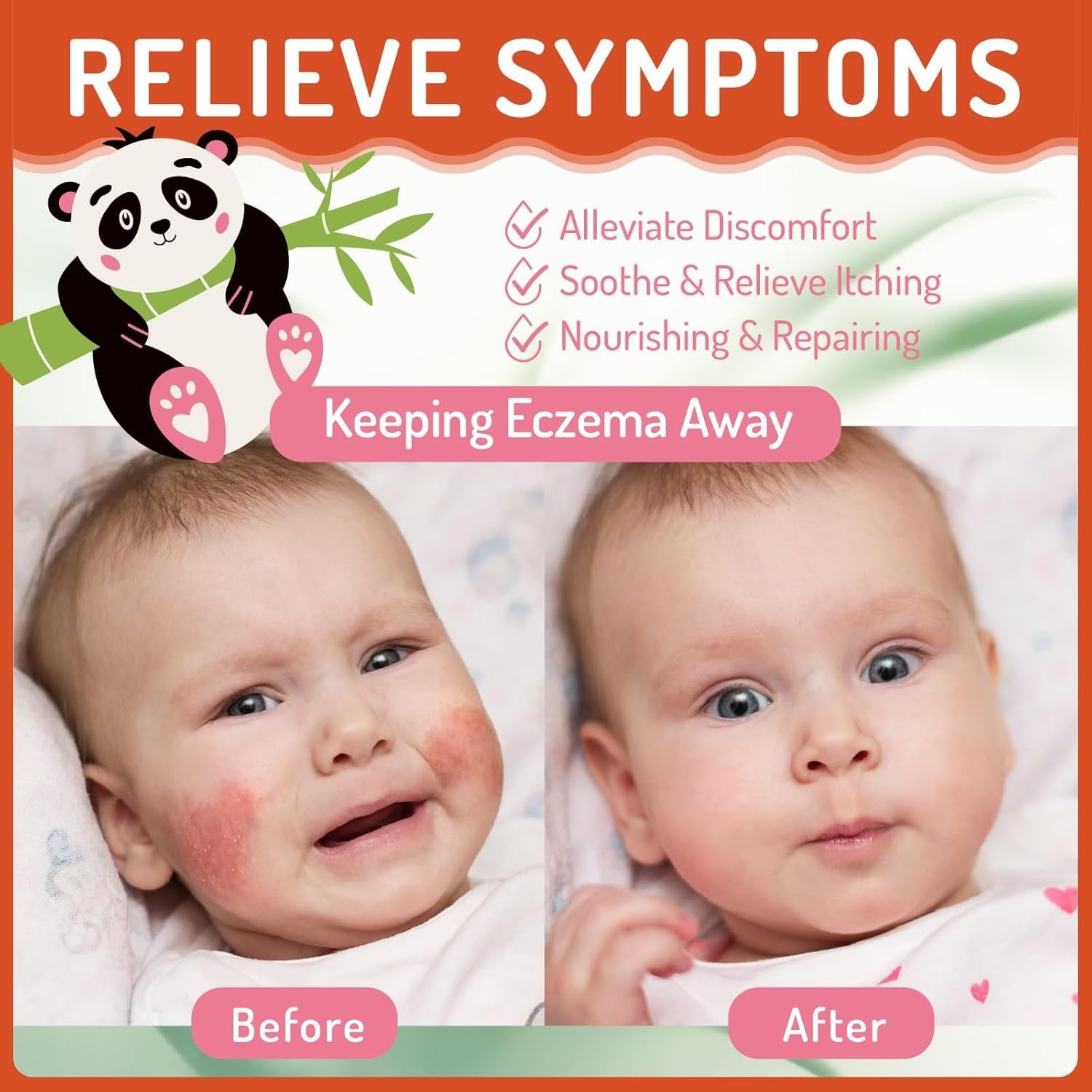 Baby Eczema Cream for Kids, Eczema Therapy & Relief Body Lotion – Nourishing