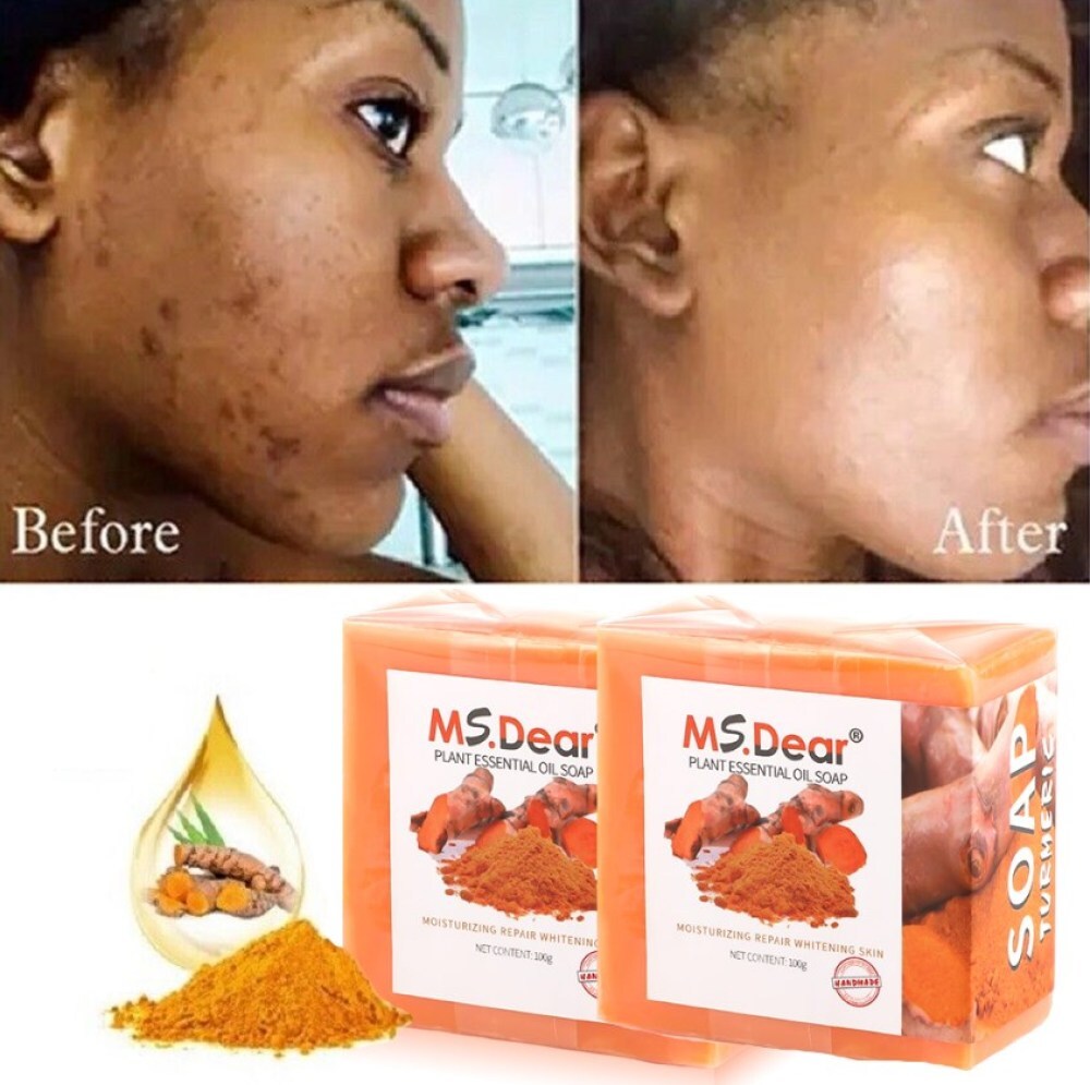 2× Tumeric Soap Skin Whitening Dark Spots lightening Acne Brightening Turmeric