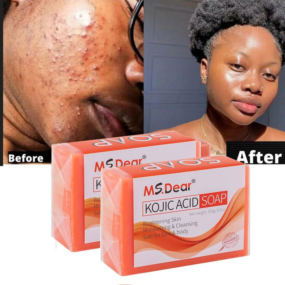 Kojic Acid Soap Dark Spot Remover Skin Lightening Face Whitening Body Bleaching