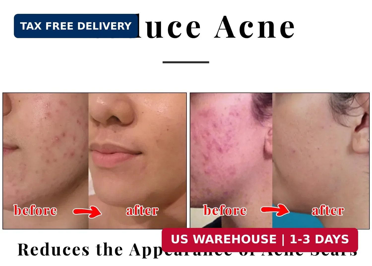 Kojic Acid Soap – 2 Bars in One Box (65g x 2) | Face & Body Cleansing Bar with T