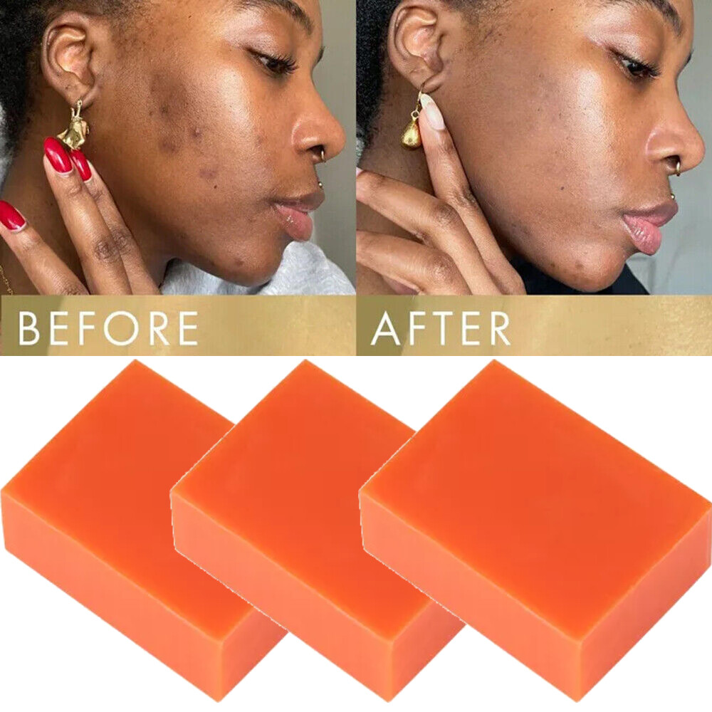 5PCS Original Kojic Acid Soap Bars Skin Whitening Turmeric Face and Body Soap