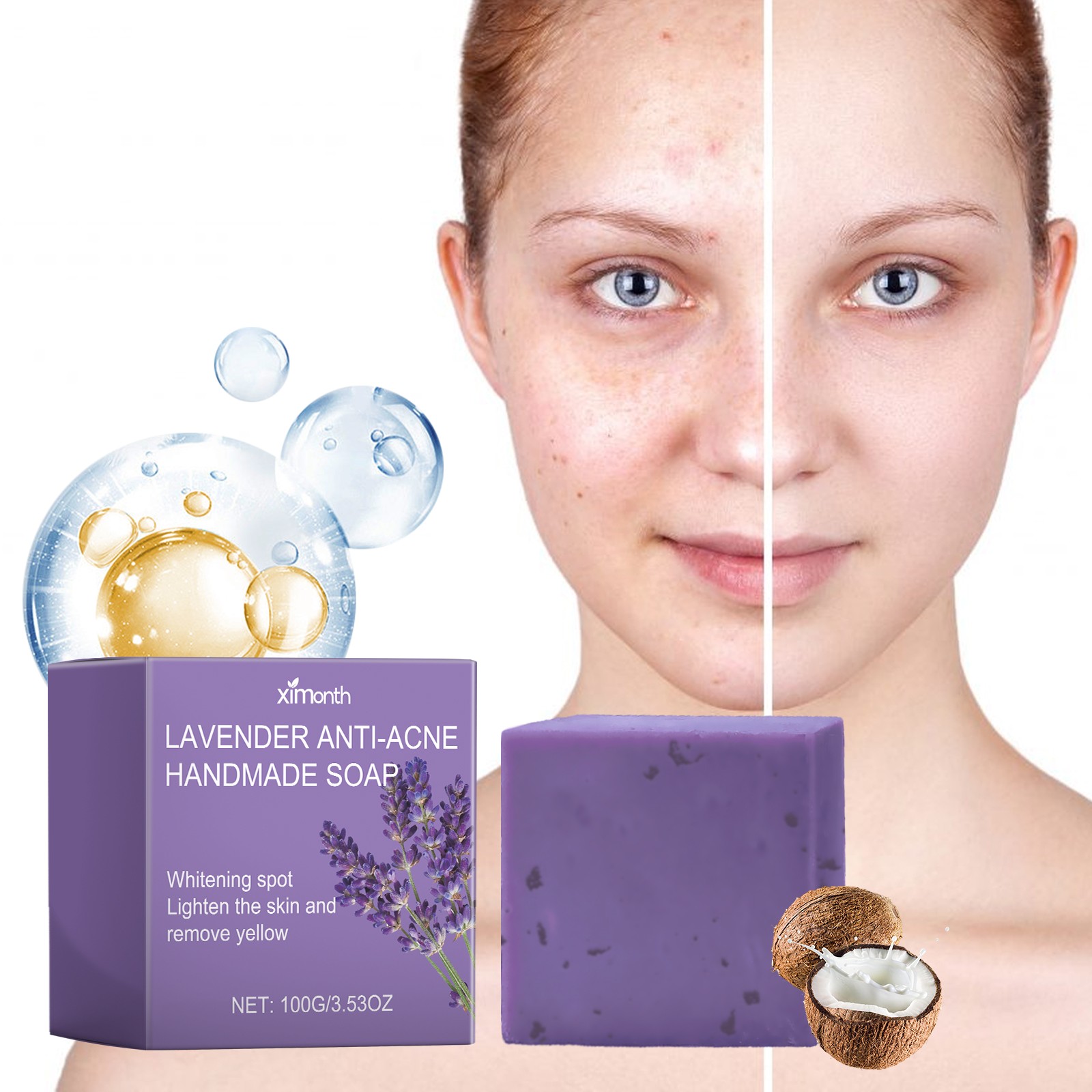 Lavender Acne Soap, Oil Control & Brightening, Vitamin C Face Soap
