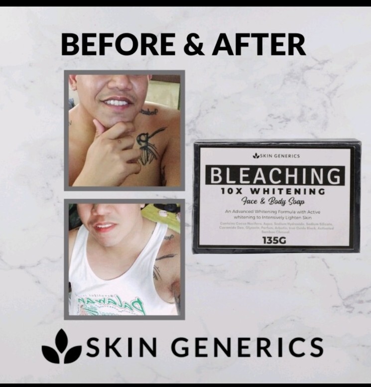 Skin Generics BLEACHING 10X Whitening Face & Body Soap 135g
