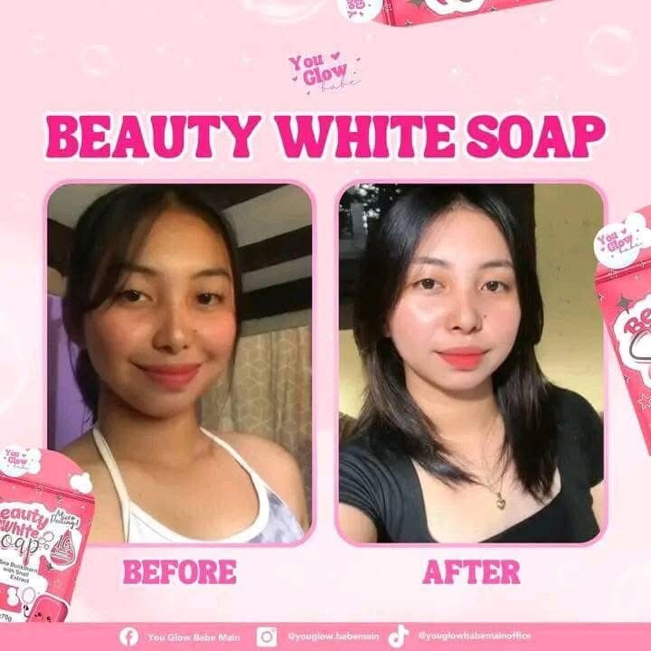 Beauty White Soap by You Glow Babe, 5 Bars x 70g (Authorized 🇺🇸 Seller)