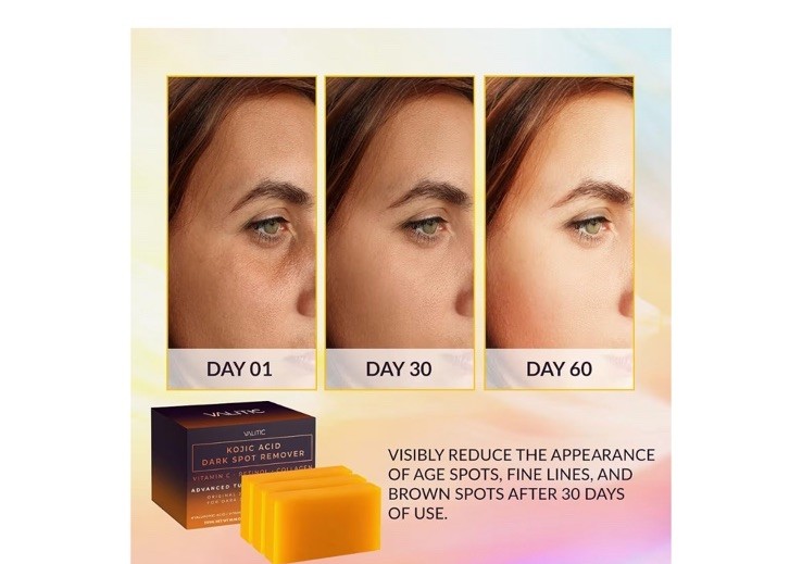 Kojic Acid Dark Spot Remover Soap with Vitamin C, Turmeric & Collagen