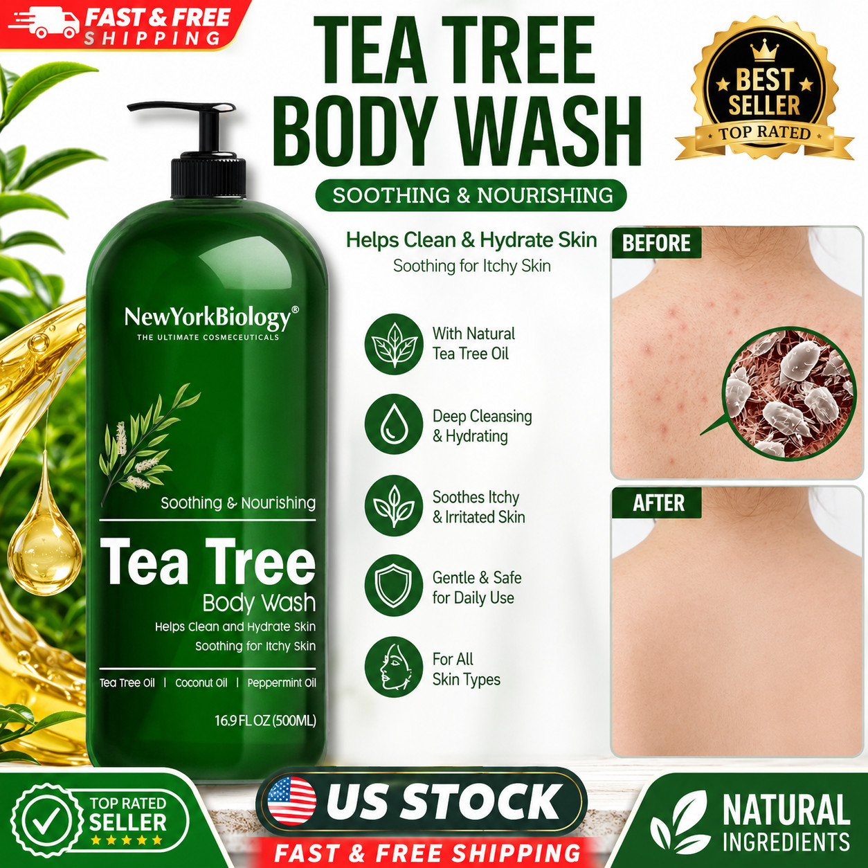 Therapeutic Soap Antifungal and Antibacterial Body Eliminate Fungus Ringworm Acn
