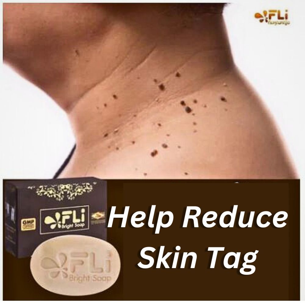 FLI Soap Bright Whitening Face Body Skin Health 9 Legendary Herb Reduce Freckles