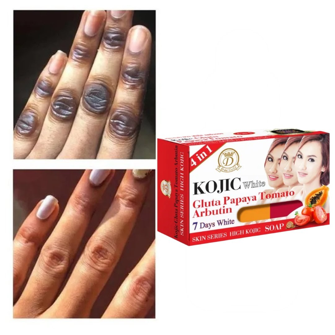 Kojic Arbutin Brightening Bar Soap Colla Skin Dark Spot Remover 160g [USA Stock]