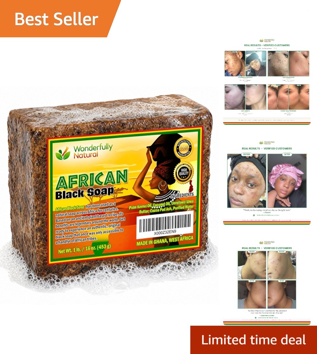 Unscented African Black Soap for Sensitive Skin – Acne & Dark Spot Solution