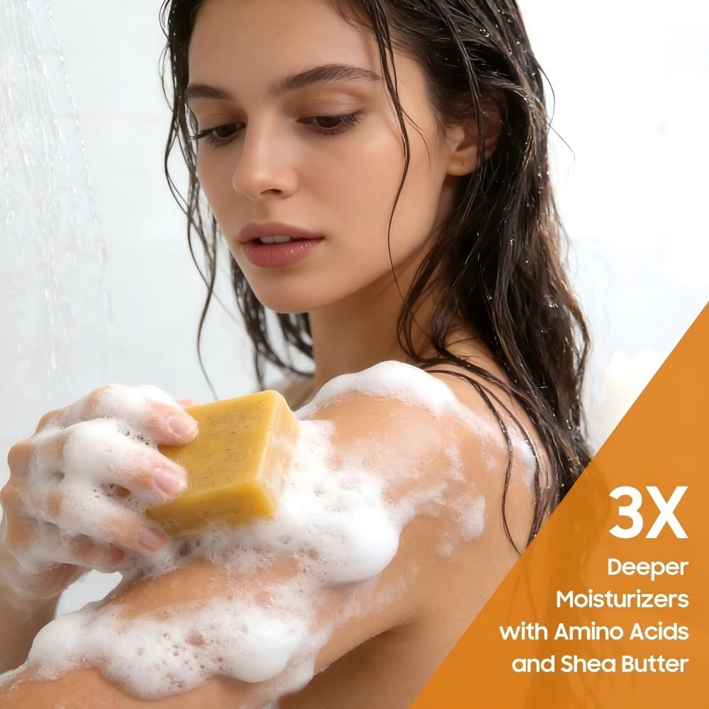 Lemon & Turmeric Soap Bar for Dark Spots, Powered by Kojic Acid & Vitamin C -…