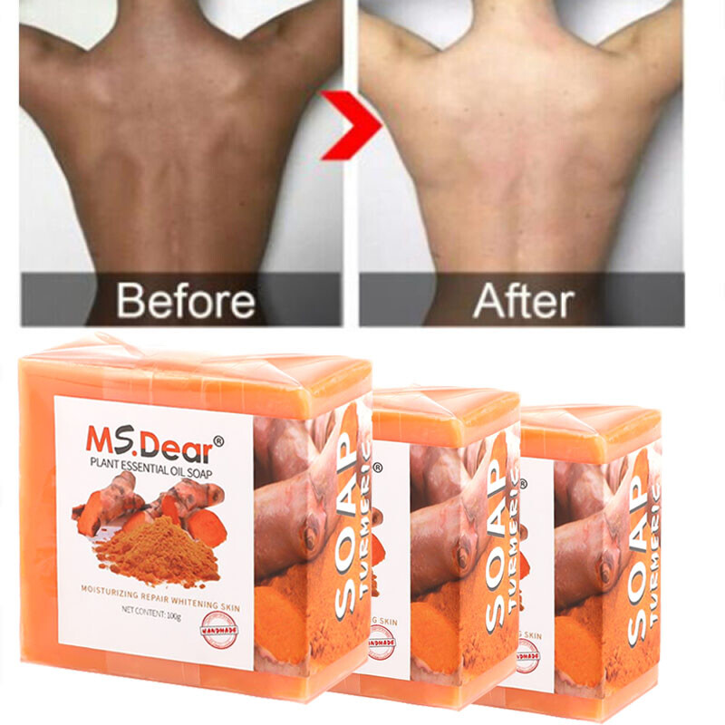 3/2Pcs Ginger Tumeric Soap Anti-Acne Dark Spots Removal Body Whitening Soap Bar