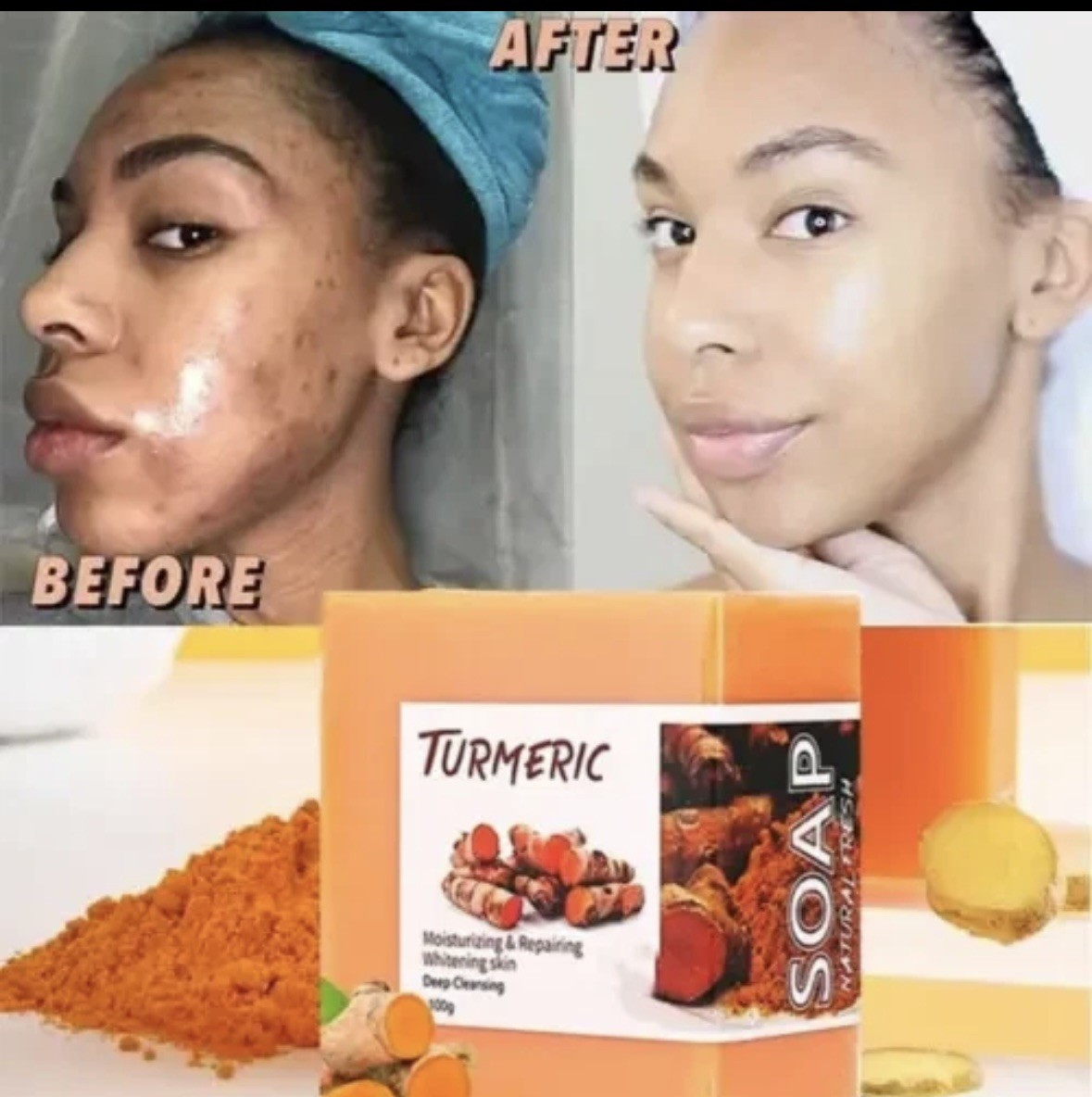 2pc Turmeric Soap Skin Whitening Dark Spots lightening Acne Brightening Turmeric
