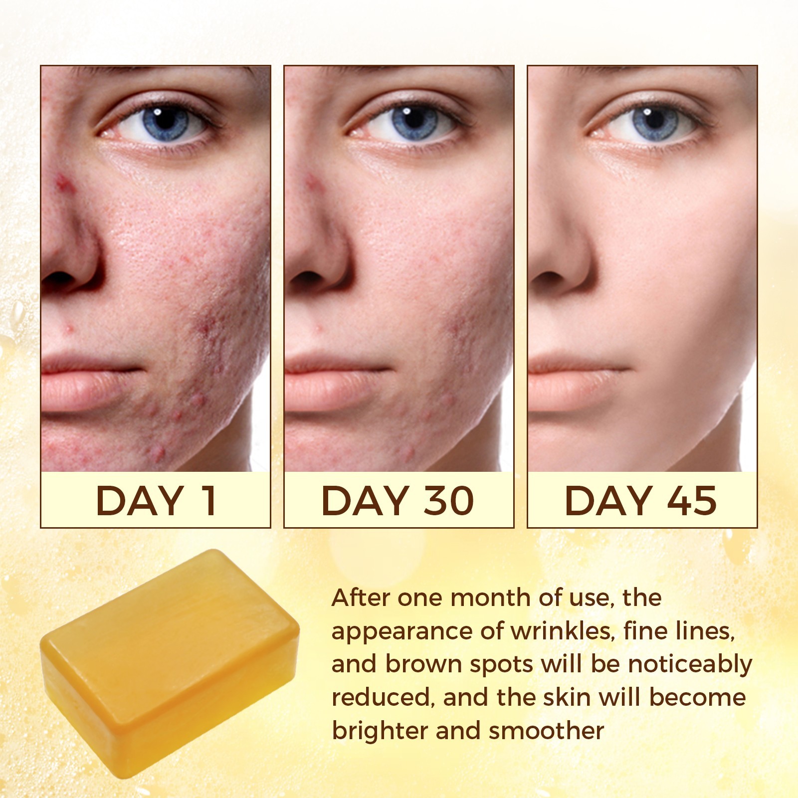 OUKEYA Turmeric Soap Bar For Dark Spot Remover with Retinol,Vitamin C,Kojic Acid