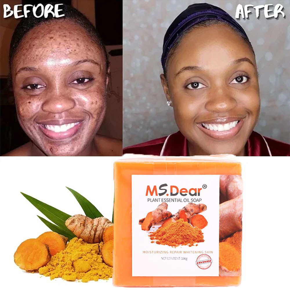 1-3x Tumeric Soap Skin Whitening Dark Spots lightening Acne Brightening Turmeric