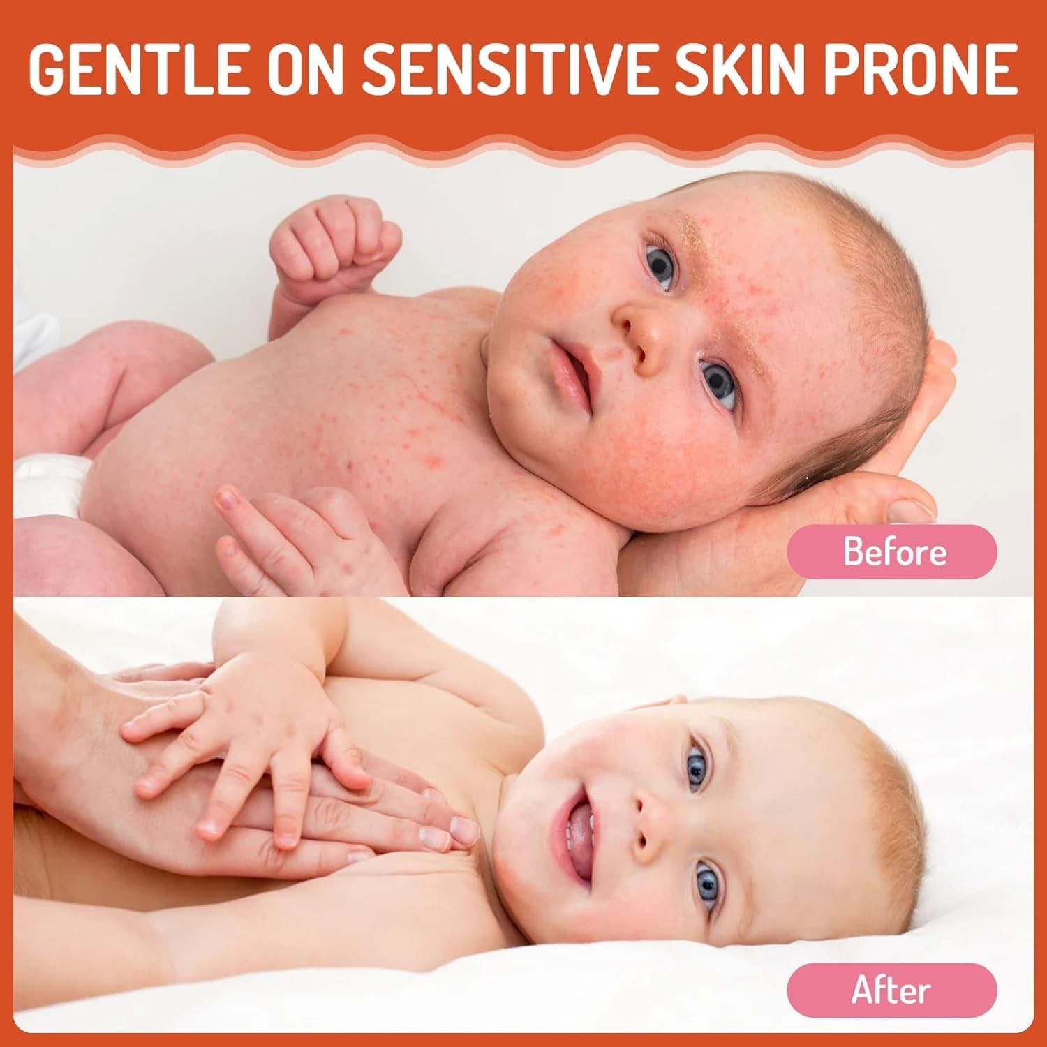 Baby Eczema Cream for Kids, Eczema Therapy & Relief Body Lotion – Nourishing