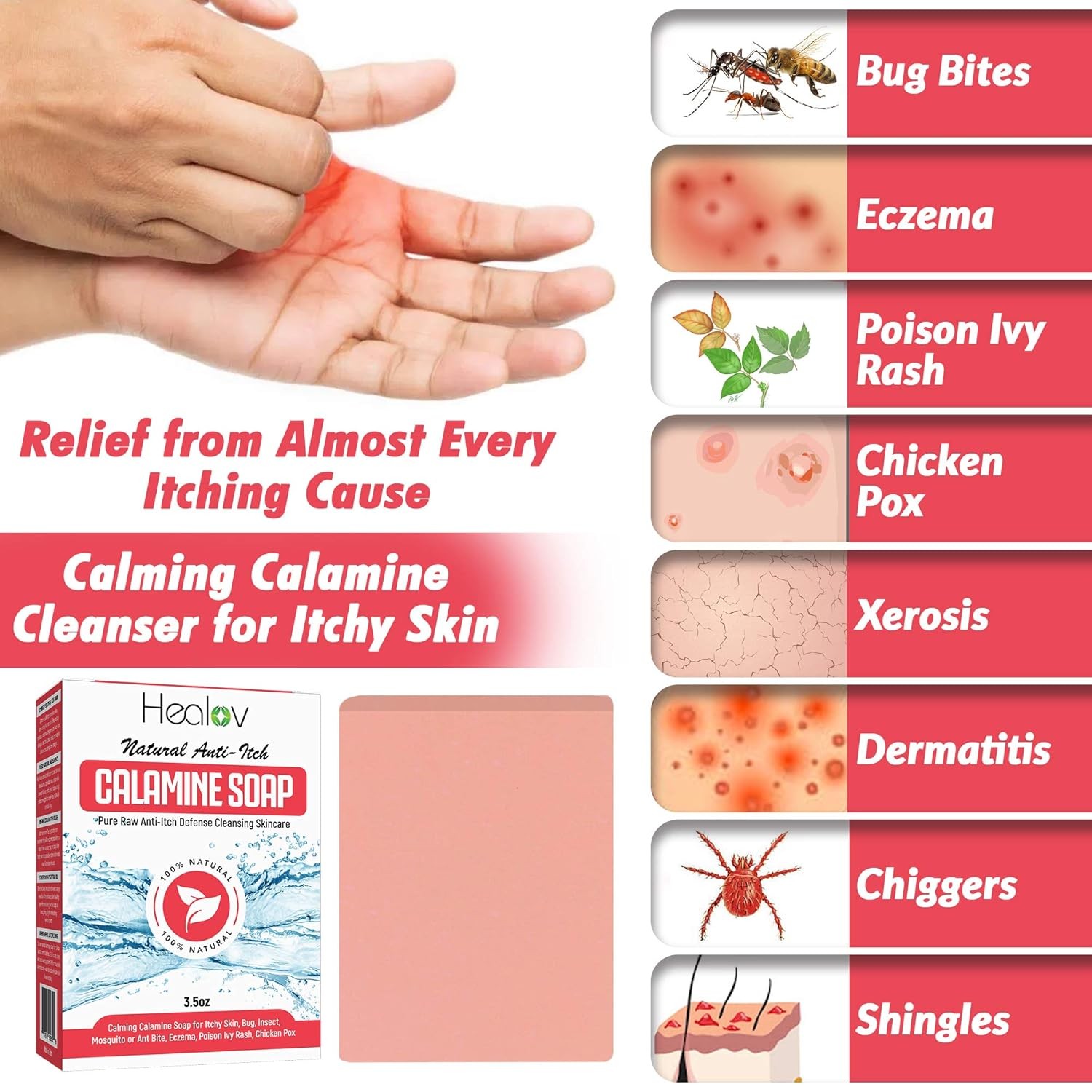 Natural Instant Itch Relief Soap Bar – Calming Calamine Soap for Itchy Skin, I