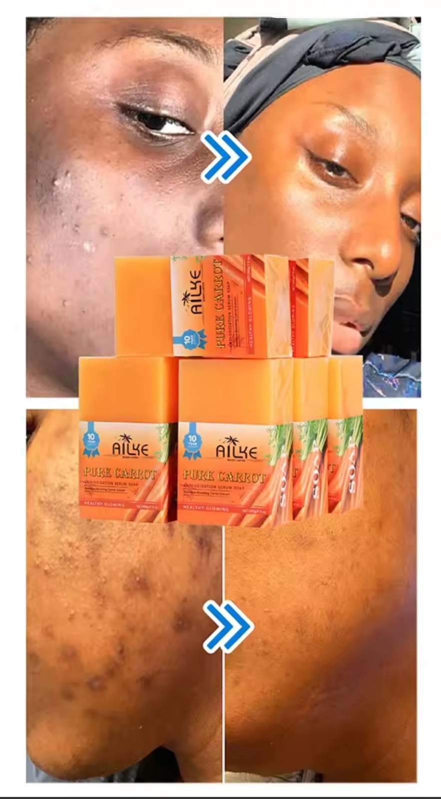 AILKE Pure Carrot Serum Soap Bar Moisturizing Deep Cleansing 200g Face/Body