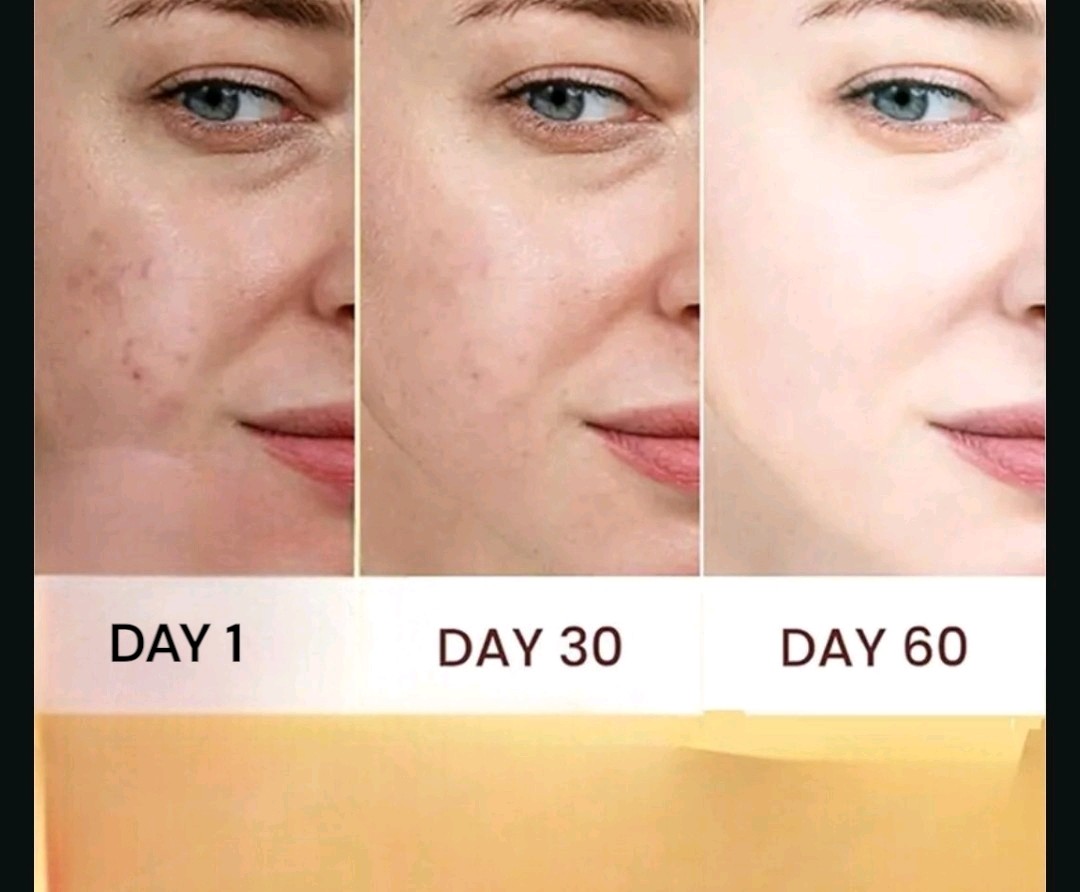 2pcs Ginger Soap Bar, Darkspots Face and Body Soap, 100g [USA Stock]