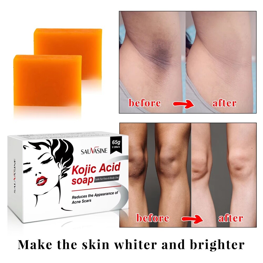 1-5X Kojic Acid Soap Dark Spot Whitening Turmeric Soap Skin Bleaching Lightening